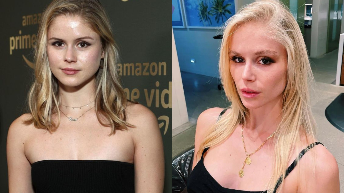 Erin Moriarty Exits Instagram Amidst Megyn Kelly's Plastic Surgery Accusations